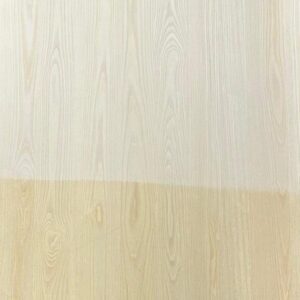 white ash crown veneer